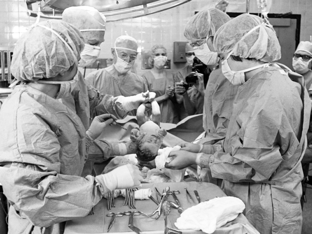 A black and white photo of doctors and nurses in a delivery room holding the first baby born from in vitro fertilization.